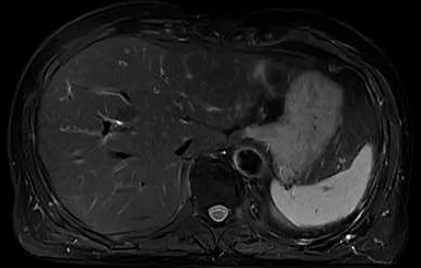 251181 MRI4ss.jpg