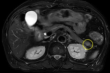 251181 MRI3ss.jpg